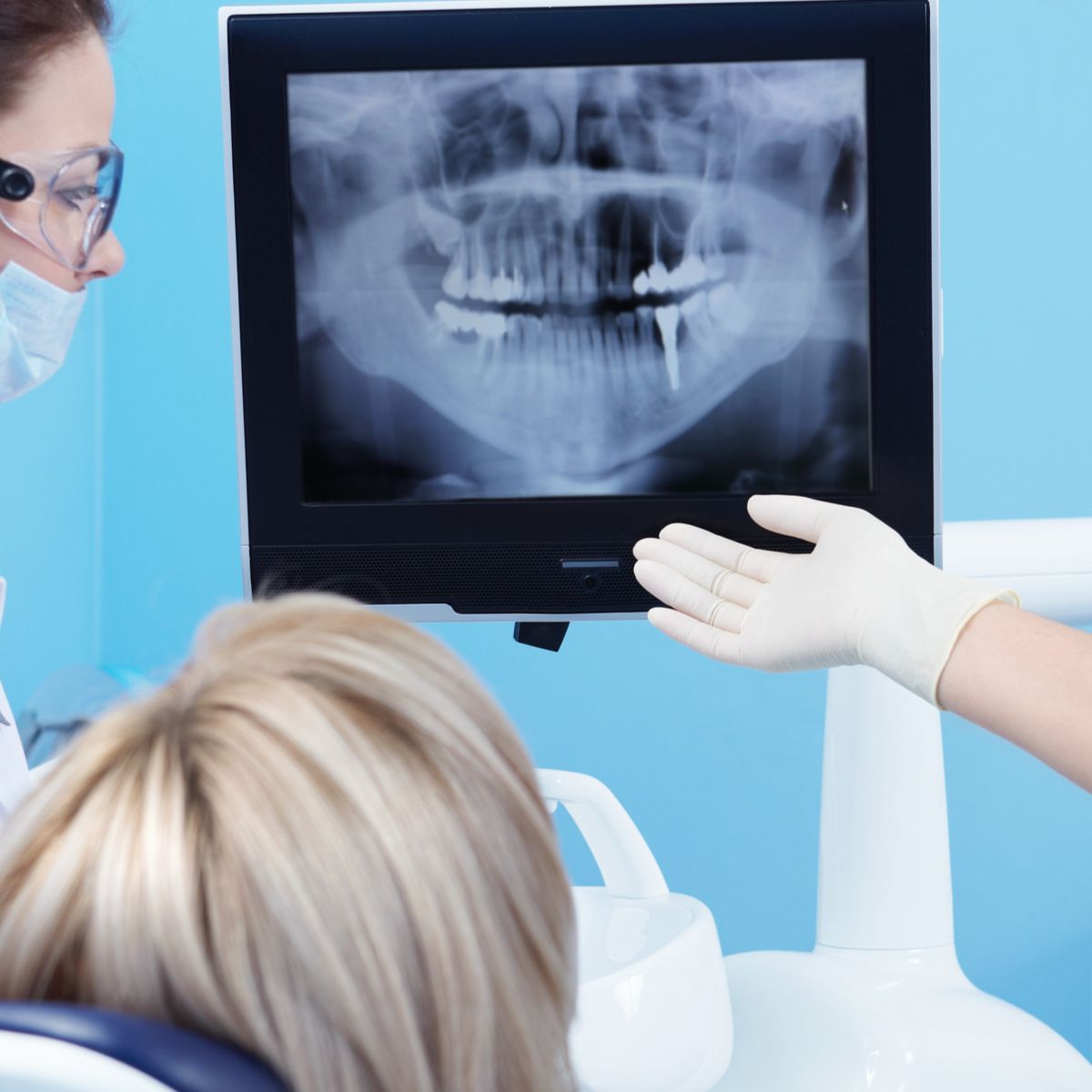 dentist looking on x-ray