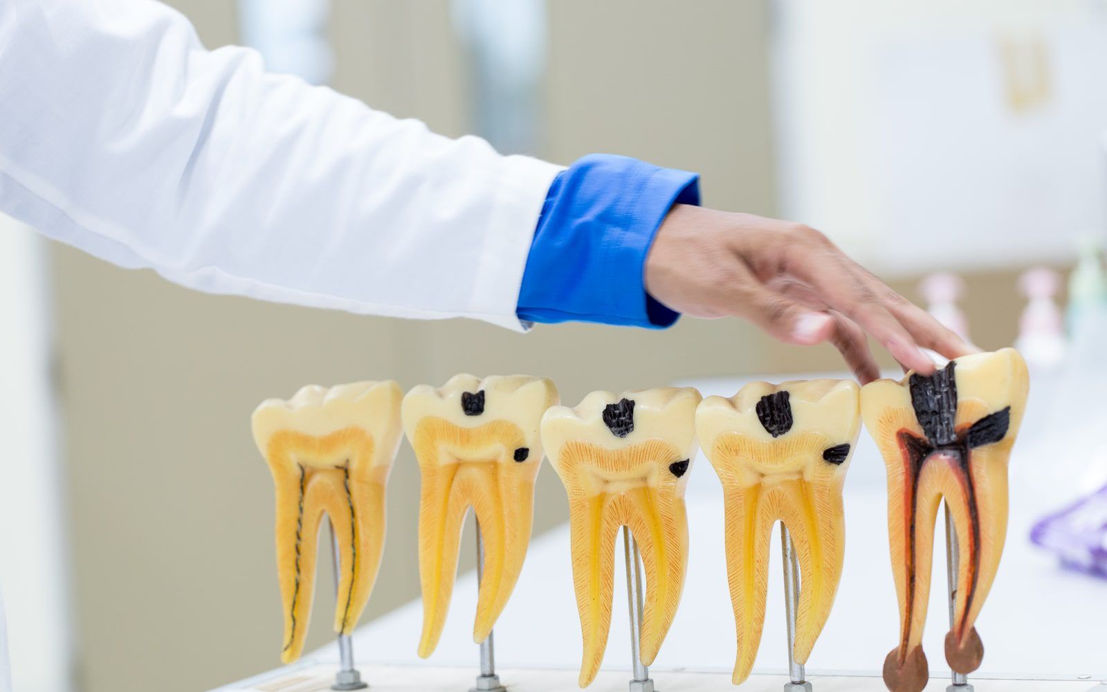 The Role Of Calcium Deposits In Causing Tooth Pain Irvine Root Canal