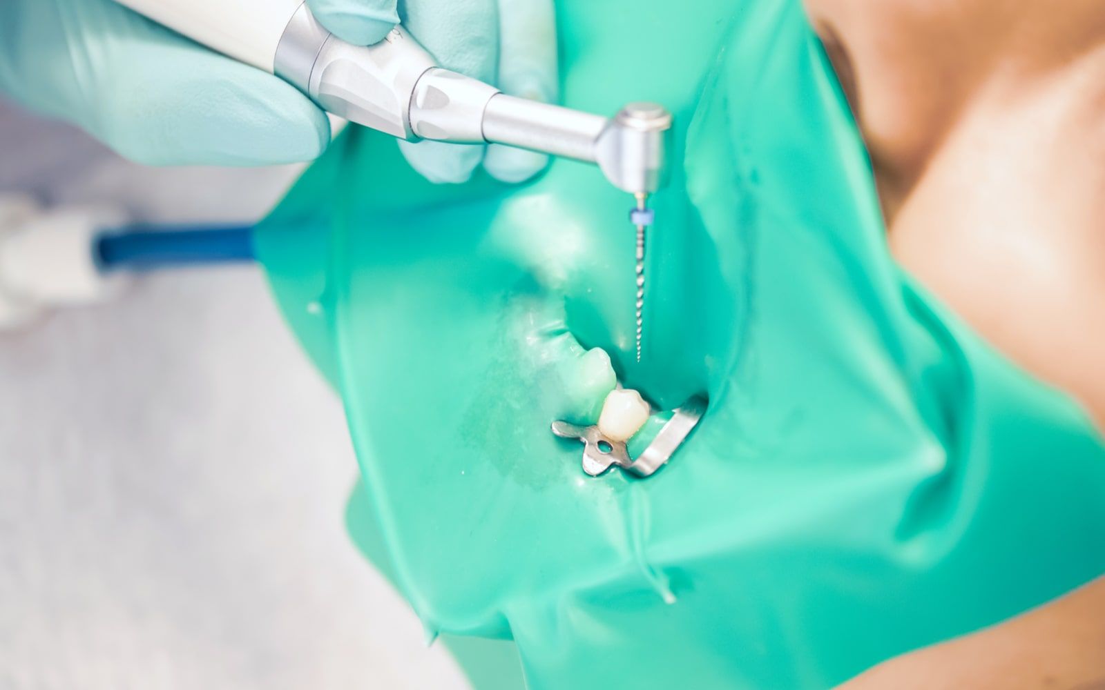 Restorative Endodontics Combining Two Disciplines For Greater Results